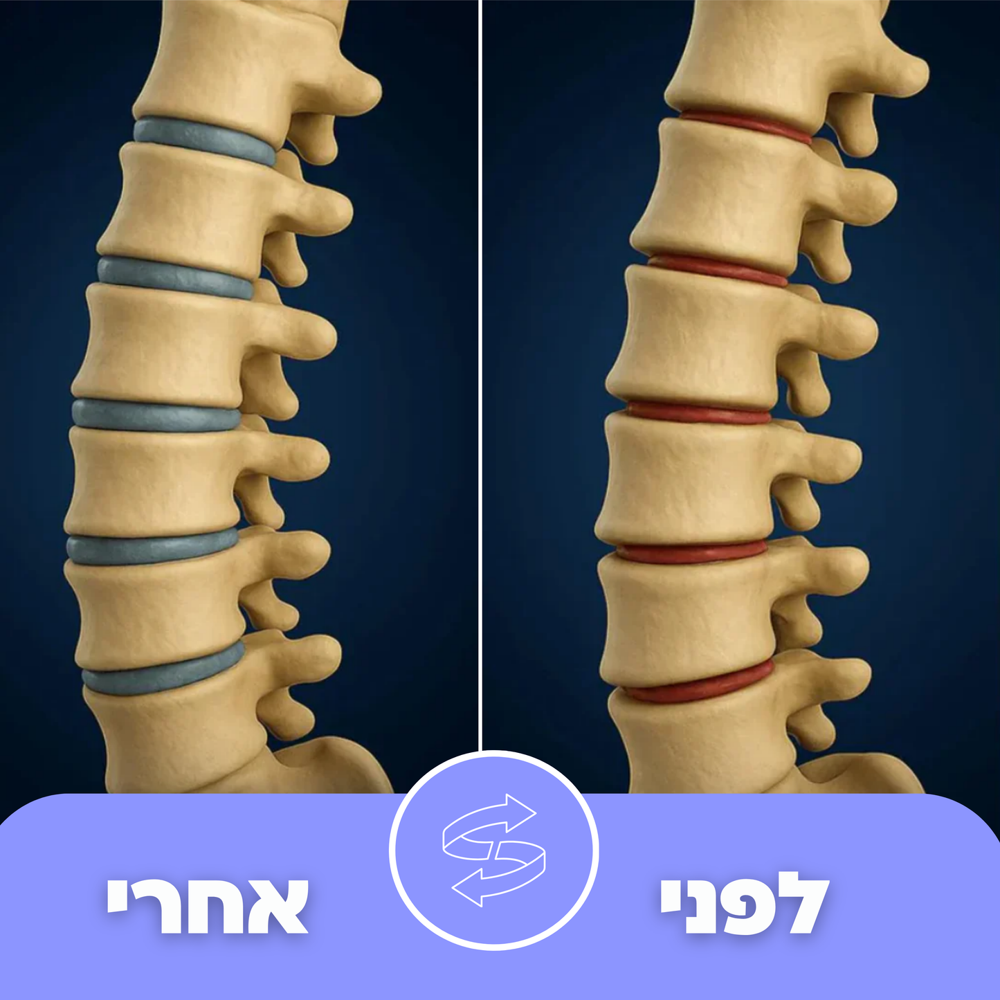כרית טיפול הגב Back+